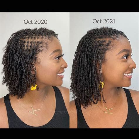 Sisterlocks Microlocks Growth 1 Year Comparison Faux Locs