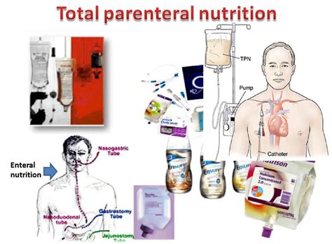 parenteral route    methods  administration