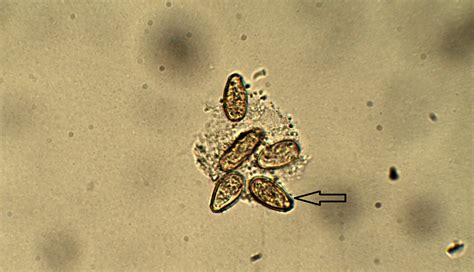 Clonorchis sinensis – Egg – Parasitology