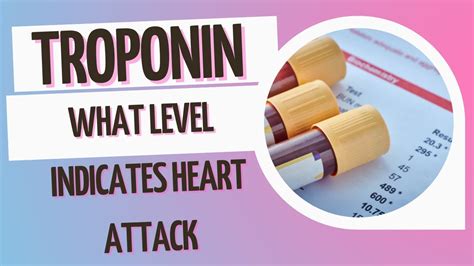 Troponin Test Normal Range What Are Troponin T And Troponin I Trop