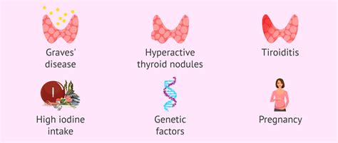 Possible causes of hyperthyroidism