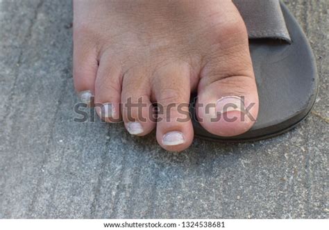 Mens Toenails Long Nails Stock Photo 1324538681 | Shutterstock