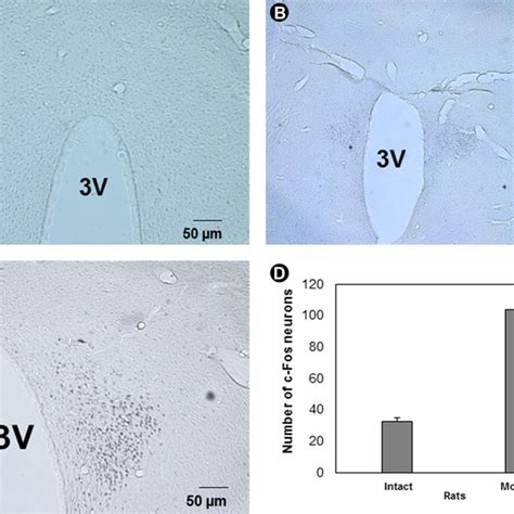 Photomicrographs Showing The Expression Of C Fos Protein In The Spinal Download Scientific