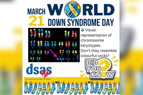 Wear Mismatched Socks To Celebrate Down Syndrome Day March 21 Sudbury