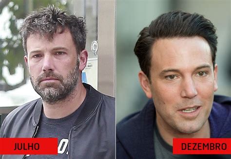 Ben Affleck surge aparência muito jovial e especialista sugere