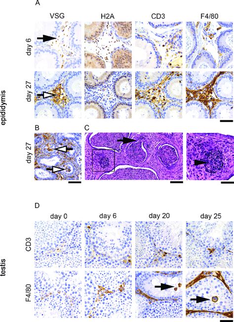 Inflammatory Cell Response Associated With T Brucei Infiltration In