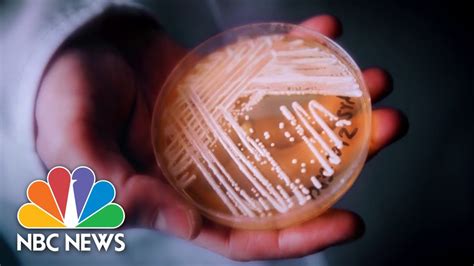 CDC warns dangerous fungus infection poses nationwide threat - The ...