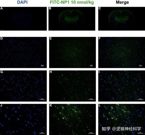 J Neuroinflammation︱昆明医科大学杨新旺团队阐述：短肽通过mir 6328 Ikkβ Nf κb轴减轻炎症对脑缺血再灌注损伤