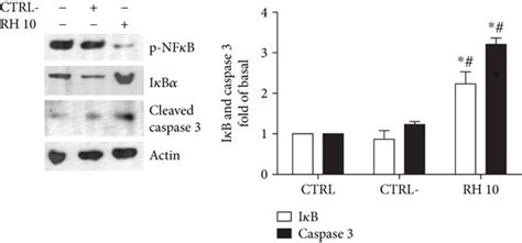 Rh Inhibits Cancer Cell Proliferation By The Modulation Of Nf B