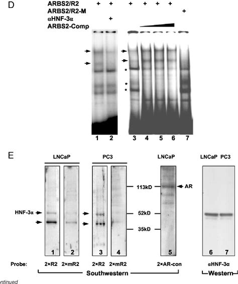 Figure From The Role Of Hepatocyte Nuclear Factor Alpha Forkhead