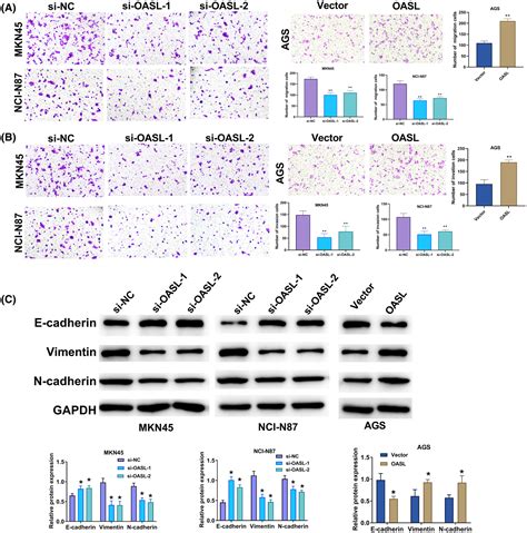 Oasl Knockdown Inhibits The Progression Of Stomach Adenocarcinoma By