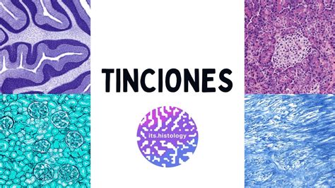 Tinciones en Histología its histology YouTube