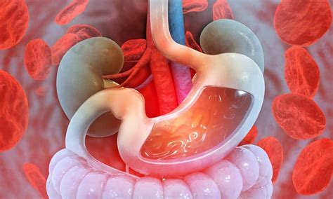 Cary Gastroenterology Associates | Possible Causes of…