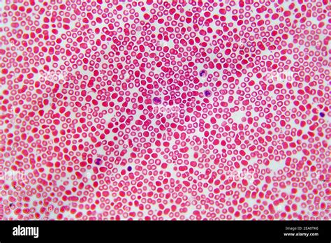 Human Blood Smear Light Micrograph Hi Res Stock Photography And Images