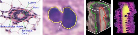 Reconstruction Challenges Of Histological Serial Sections From Light