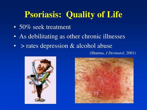 Ppt Overview Of Psoriasis Powerpoint Presentation Id4844117