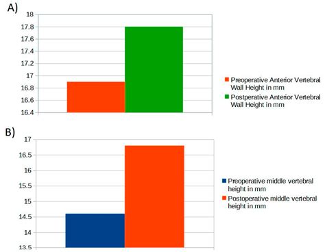 Jcm Free Full Text Percutaneous Vertebral Reconstruction Pvr