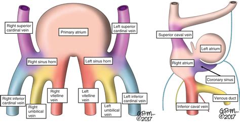 Anomalous Systemic Venous Return Clinical Tree