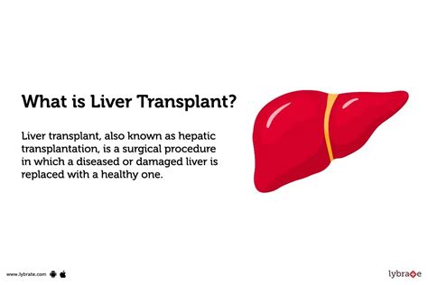 Liver Transplant Purpose Procedure Benefits And Side Effects