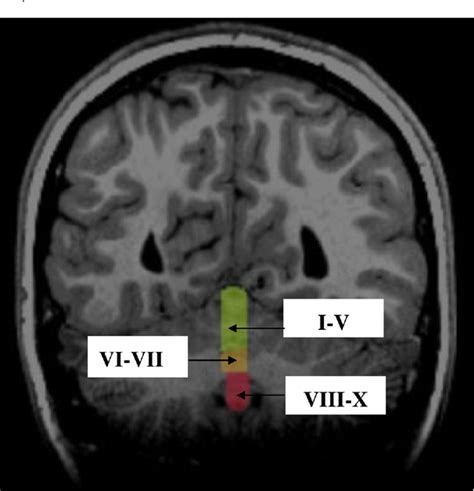 Figure 2 From Neuroanatomical And Neuropsychological Correlates Of The