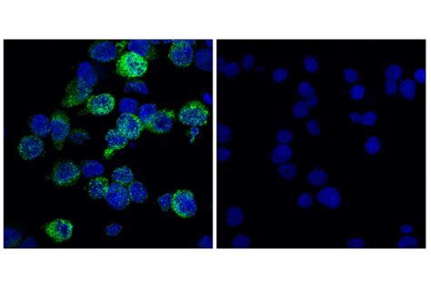 Mouse Reactive M1 vs M2 Macrophage IHC Antibody Sampler Kit | Cell ...