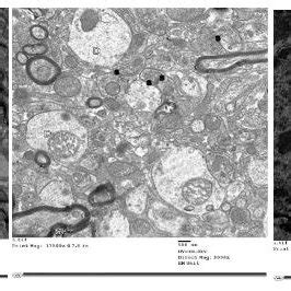 Electron Micrograph Of Ultrathin Section Shows That Neuronal Cells With