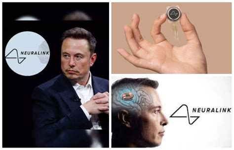 Elon Musk S Neuralink Implants The First Brain Chip In A Human Oyeyeah