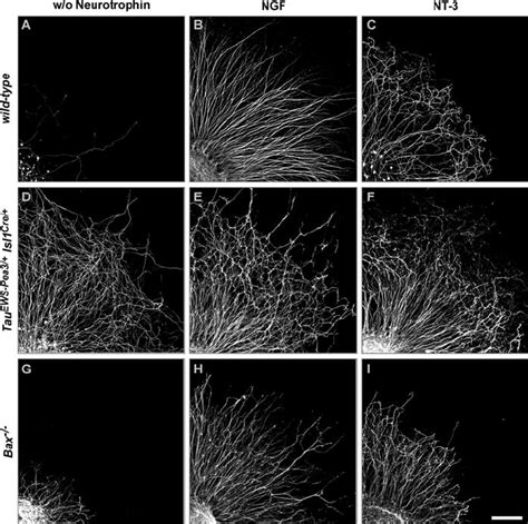 Neurotrophin Independent Neurite Outgrowth In Vitro Of Drg Neurons