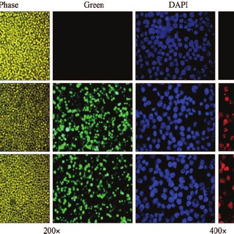 Photomicrographs Of Bjab Cells And Kshv Bjab Cells 2 Weeks And 2 Months Download Scientific