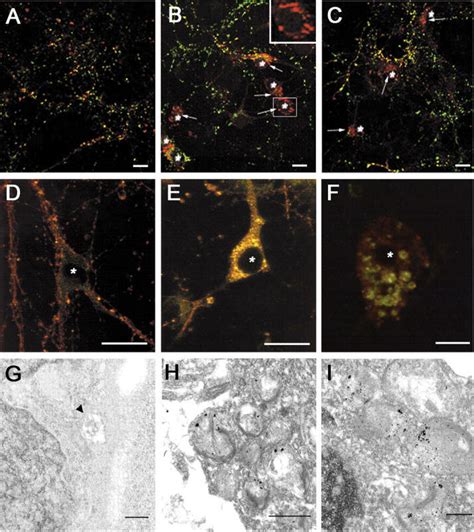 Perinuclear Synuclein Accumulations Can Be Visualized In Association