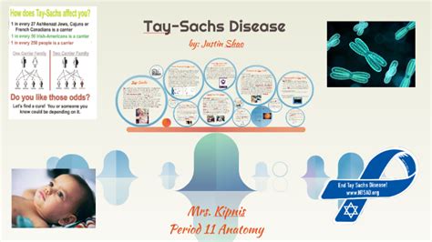 Tay Sachs Disease By Justin Shao On Prezi