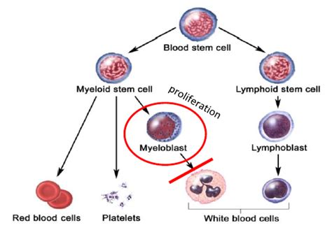 Chemotherapy And Targeted Therapy For Acute Myeloid Leukemia Aml Yersinclinical