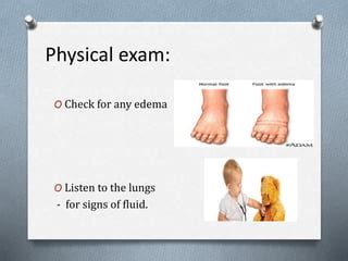 Hypervolemia (Fluid overload) | PPT