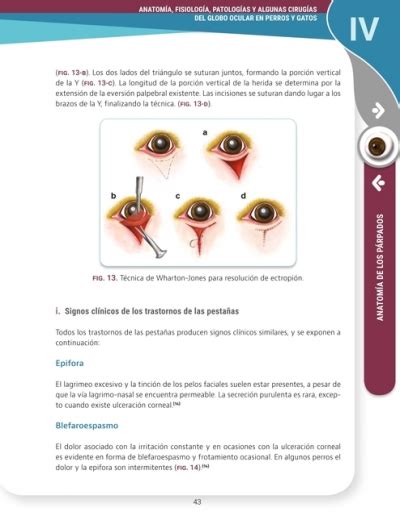 Anatomía fisiológia patologías y algunas cirugías del globo ocular en