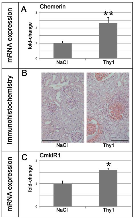 Renal Chemerin Expression Is Induced In Models Of Hypertensive