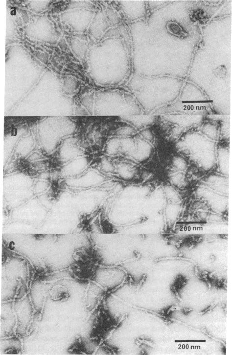 Figure 1 From In Vitro Reconstitution Of Intermediate Filaments Form