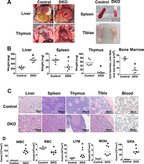 Vav1 Cre Mediated Hematopoietic Deletion Of Cbl And Cbl B Leads To Jmml