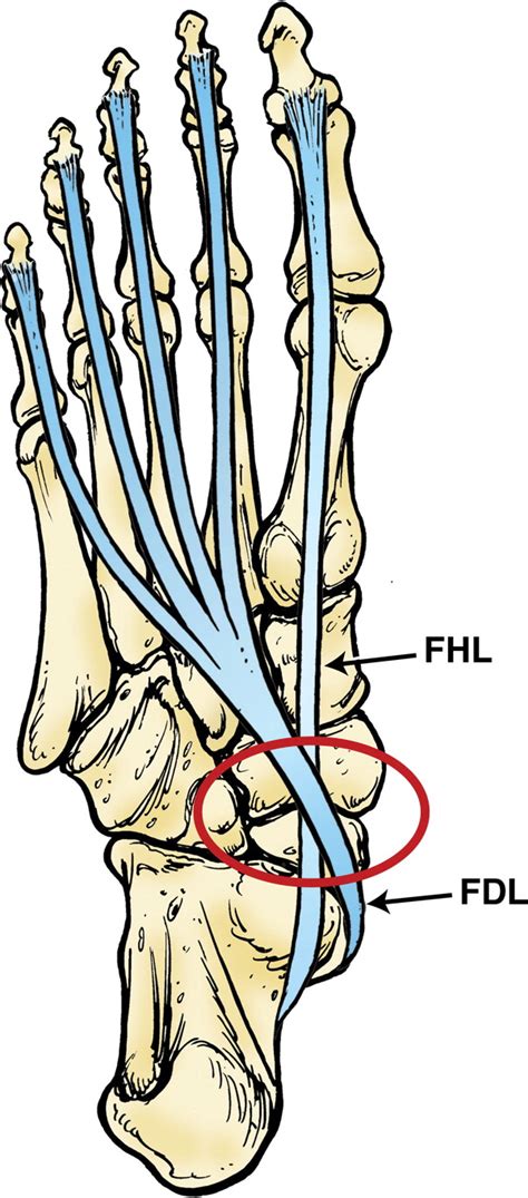 Plantar Tendons Of The Foot Mr Imaging And Us Radiographics