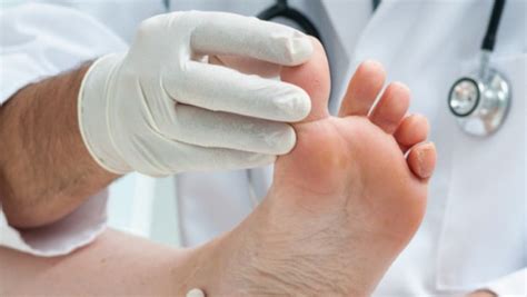 Sprained Toe: Causes, Symptoms, Diagnosis, Treatment, Prevention ...