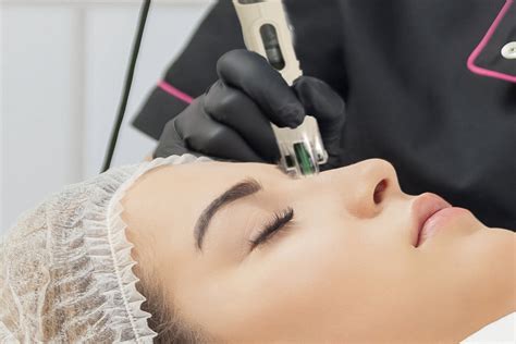 Dermafrac Dermal Micro Needling System — Atone Skin Clinic