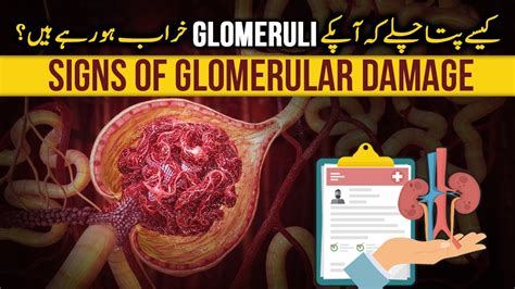 How To Recognize Glomerular Disease Diagnosis Steps From Symptoms To