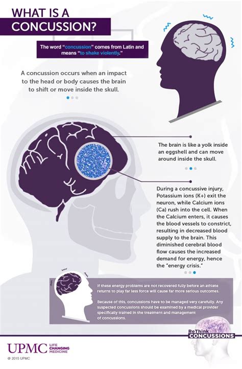 Image Result For Concussion Infographic Concussion Infographic