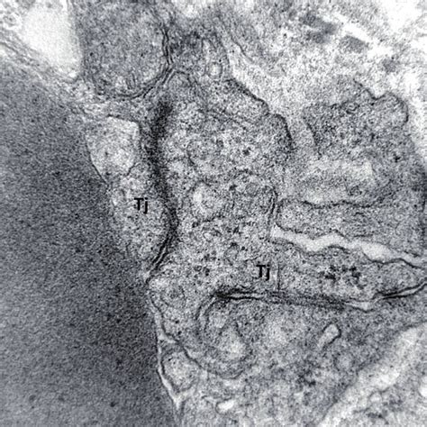 Disruption Of The Tight Junctions Tj Of A Brain Capillary Electron