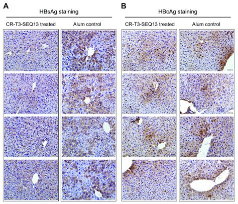 Immunohistochemical Staining Of Hbsag And Hbcag In The Livers Of Hbv Tg Download Scientific