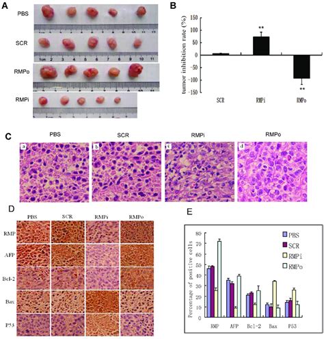 Rmp Promotes The Growth Of Hcc Xenograft Tumors In Vivo A Smmc 7721 Download Scientific