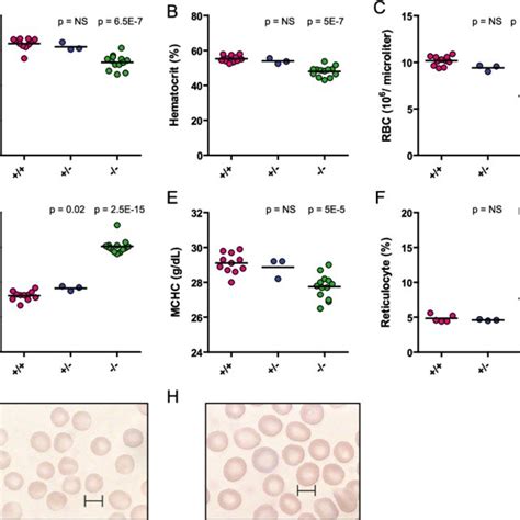 Hematological Analysis Of Ccnd3 Knockout Mice Reveals A Dramatic