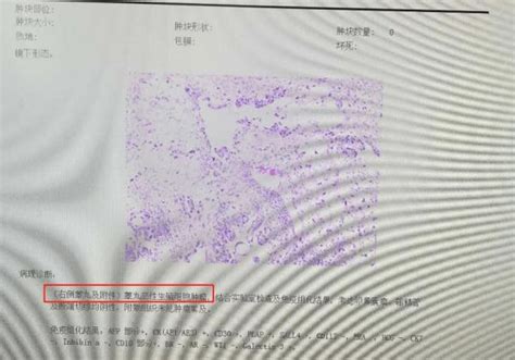 15歲男孩查出睪丸癌：就因為半年前被人撞了一下？ 每日頭條