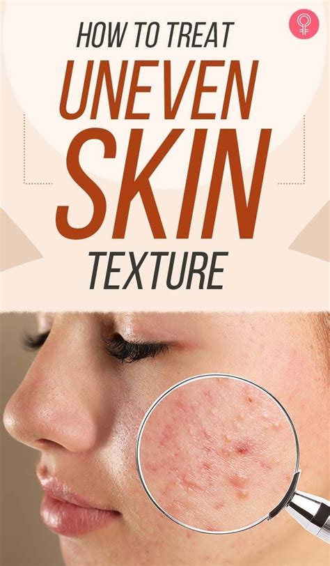 How To Treat Uneven Skin Texture Fitforallages