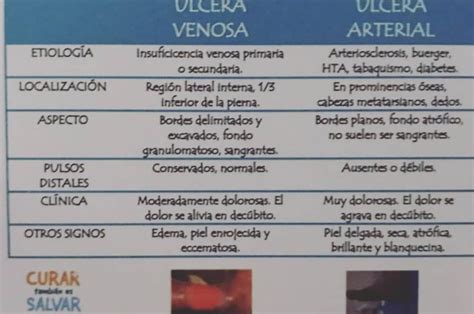 Diferencia Entre La Lcera Venosa Y La Arterial Arterias Y Venas The