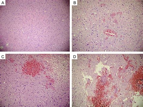 Bleeding for all groups in histopathological evaluation. Bleeding was ...